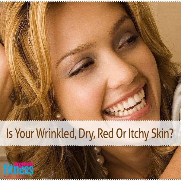 Is Your Wrinkled, Dry, Red Or Itchy Skin?