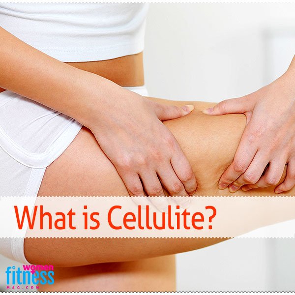 What is Cellulite? What is Cellulite, la cellulite, anti cellulite, cellulite treatment, cellulite cream, Cellulite thighs, cellulite massage, nivea cellulite, cellulite legs, gegen cellulite, cellulite treatment, cellulite removal, cellulite reduction, get rid of cellulite, cellulite exercises, how to get rid of cellulite, stretch mark removal, mesotherapy, cellulitis, What is Cellulite