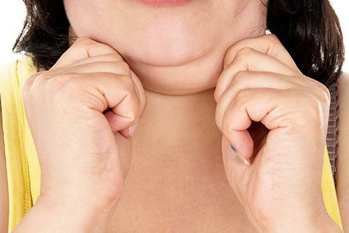 Ways to Minimize Stubborn Face Fat