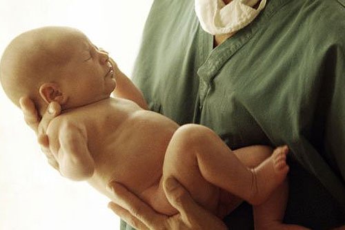 Deaths due to birth defects can be prevented: WHO