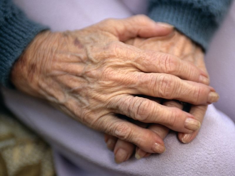 4 in 10 People Will Suffer Arthritic Hands Over Lifetime