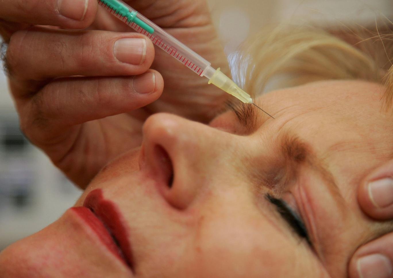 Botox and ketamine could help treat depression, study finds