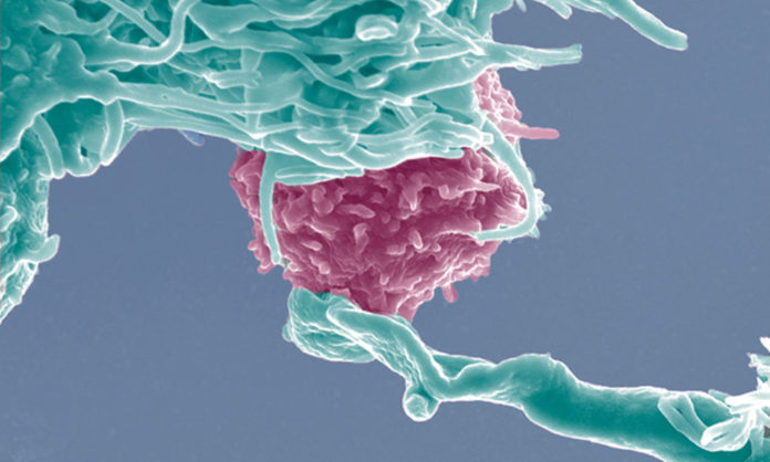Answering your questions about cancer, inflammation, and immunity Answering your questions about cancer, inflammation, and immunity