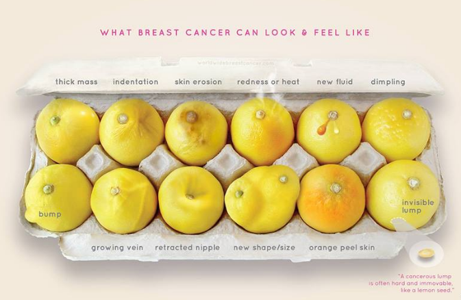 Breast Cancer Indicators explained through Lemons