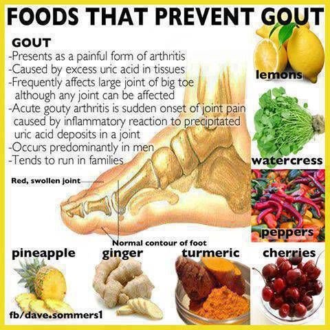 Natural Remedies For Your Gout Pain