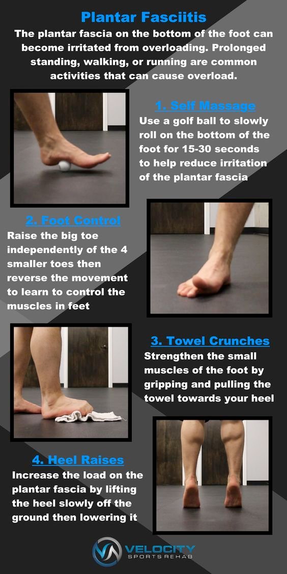 physiotherapy treatment for heel spur