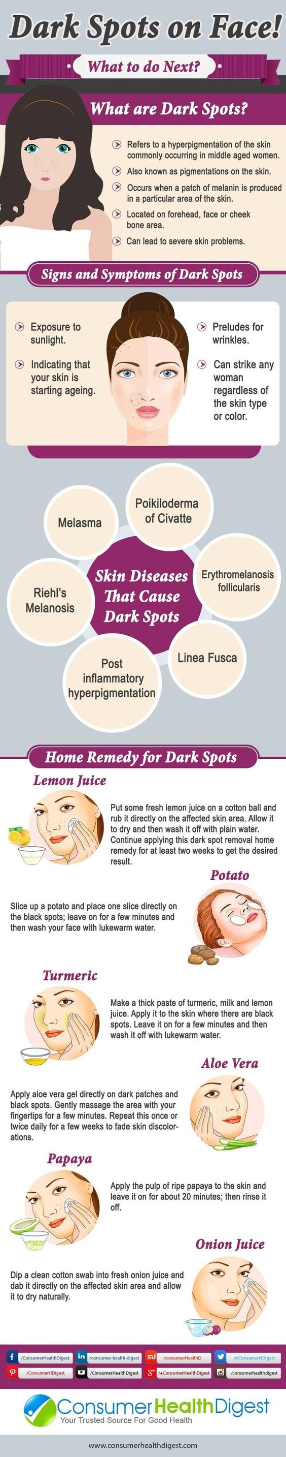 How to get rid of Dark spots