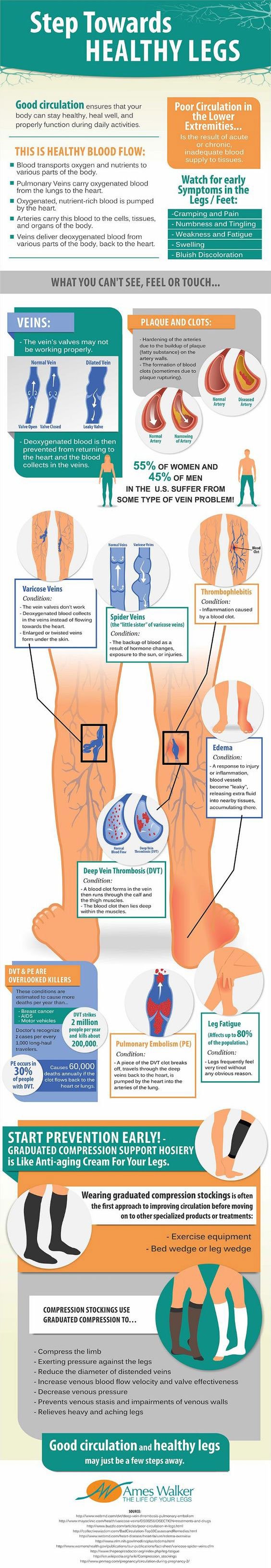 Treatments for Aching Legs and Feet