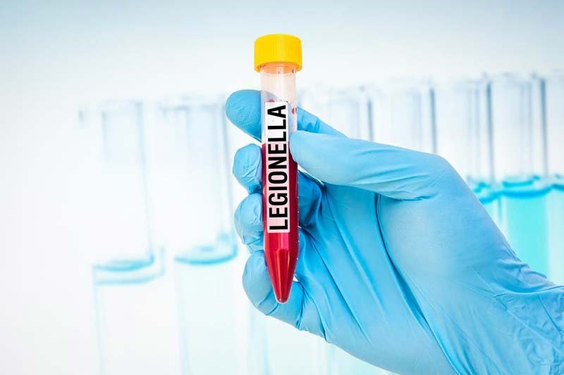 Legionella Testing Kits – Yes, you Need One! legionella test strips, legionella field test kit, legionella testing equipment, rapid legionella test kit, who can test for legionella, legionella water testing, legionella testing procedure, legionella testing cost,