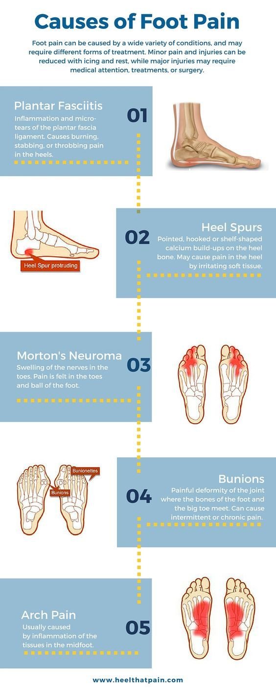 Mistakes That Cause Foot Pain