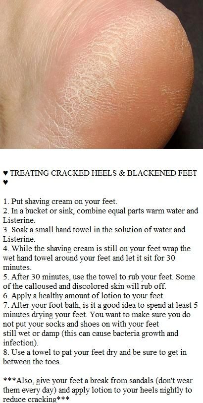 How to Keep Your Feet Healthy and Soft