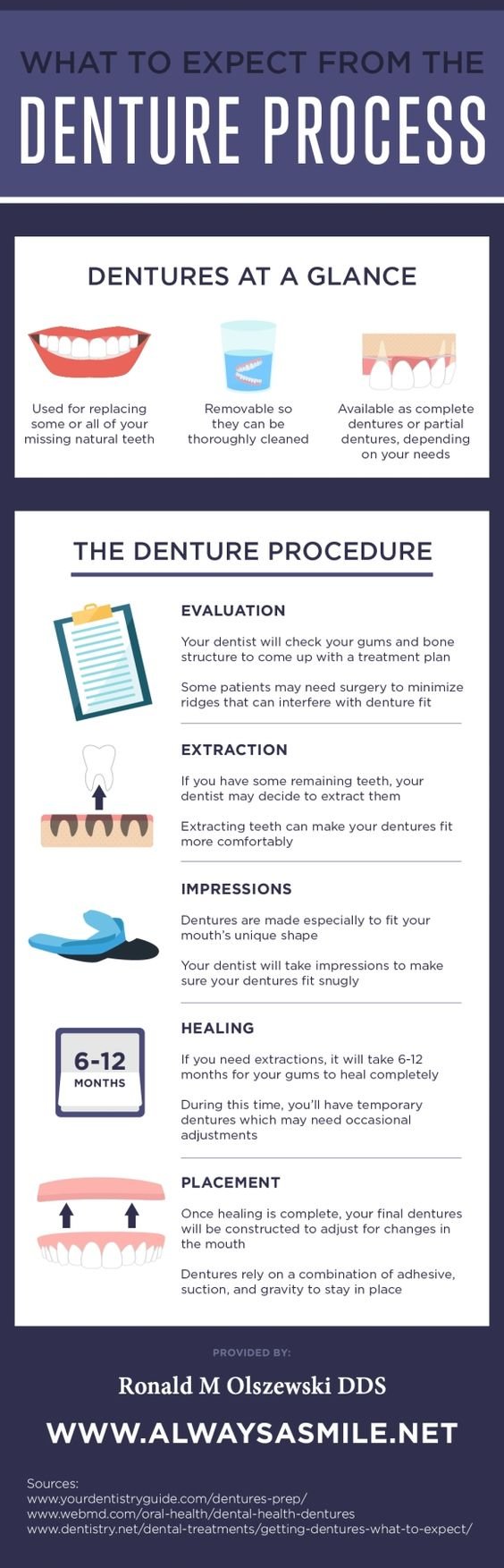 What to expect from Denture process