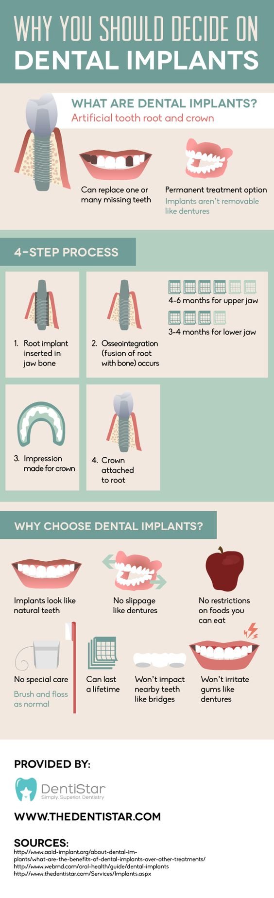 Why you should decide on dental implants