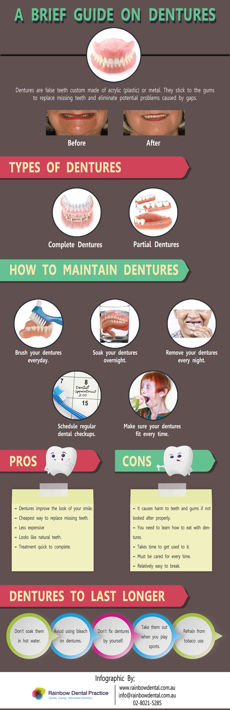 brief guide dentures