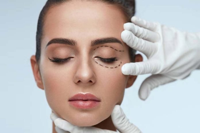 eye bag surgery