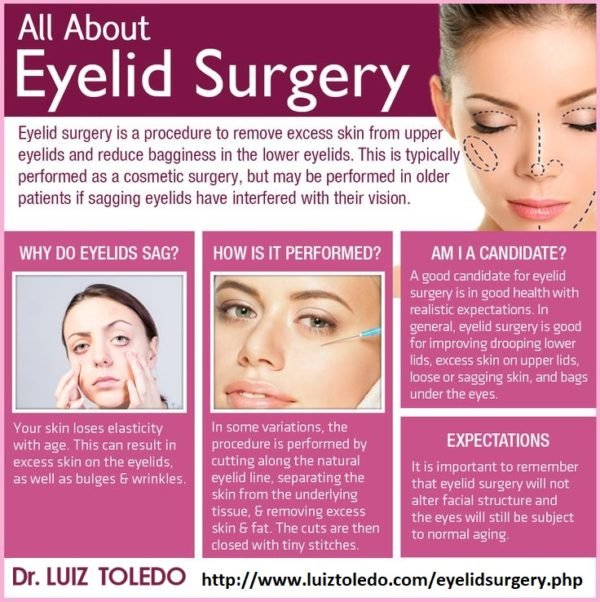 The Pros and Cons Of Cosmetic Surgery For Eye Bag Lift