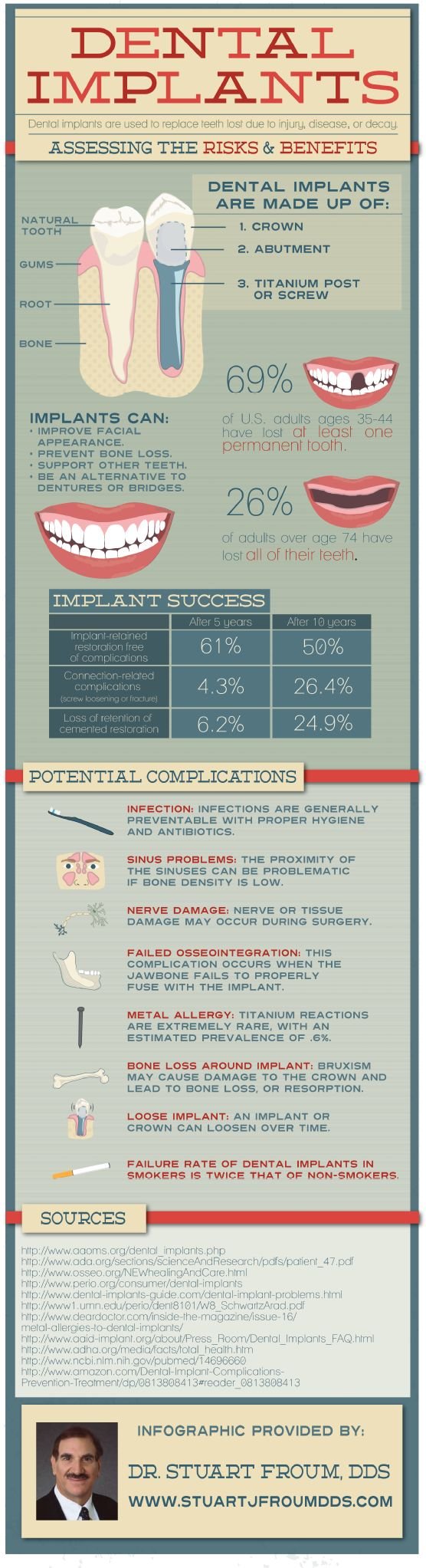 assessing the risks and benefits of dental implants