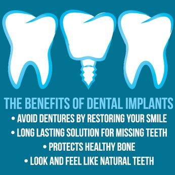 benefits of dental implants