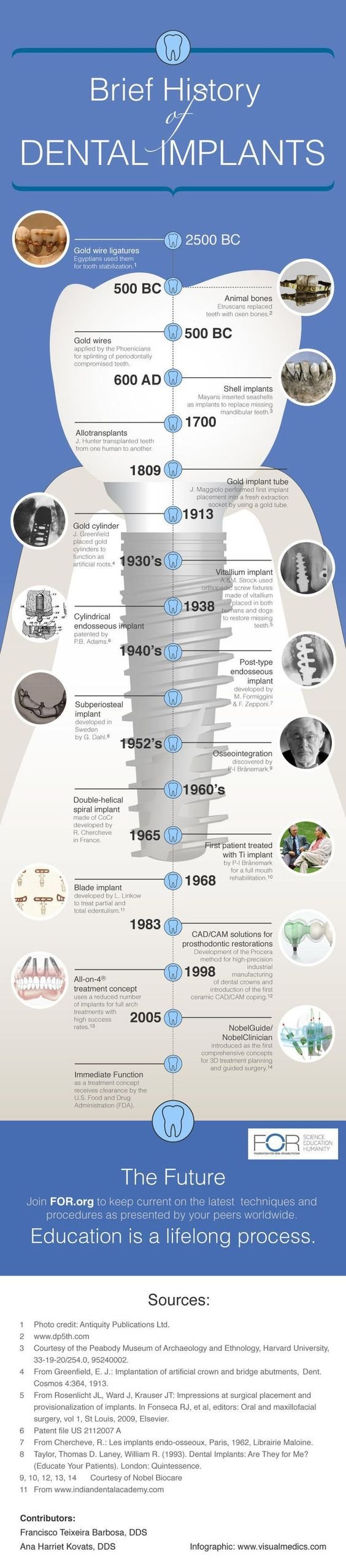 brief history of dental implants