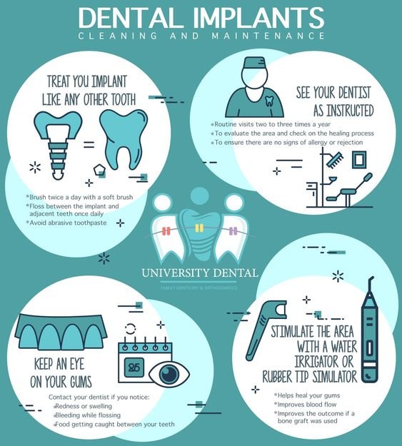 dental implants cleaning and maintenance