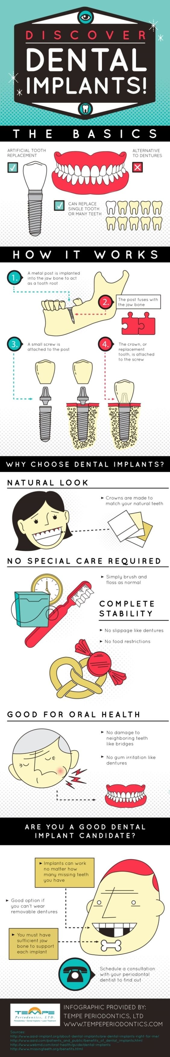 discover dental implants