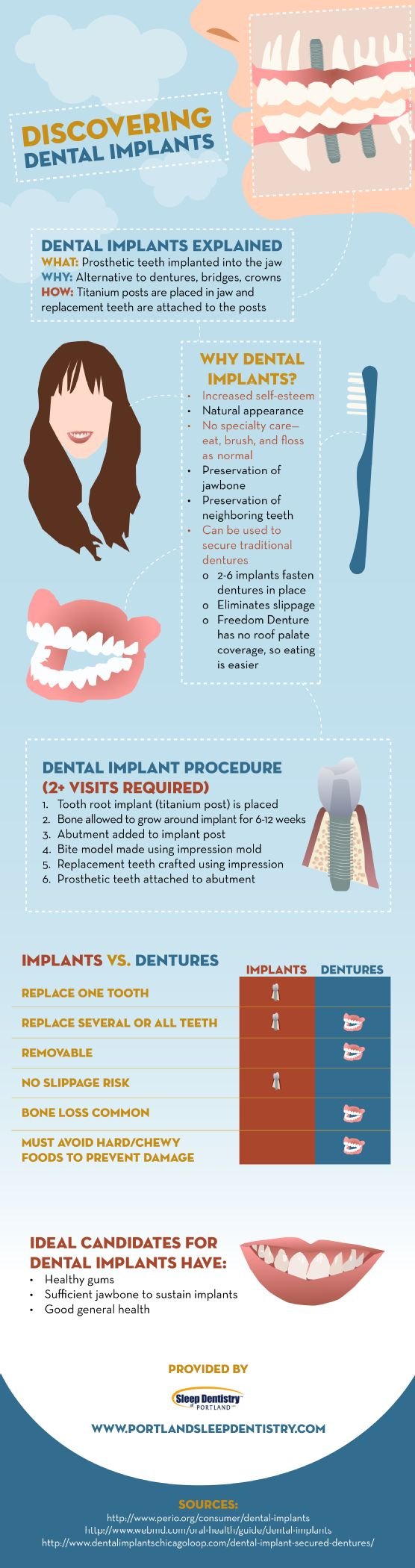 discovering dental implants