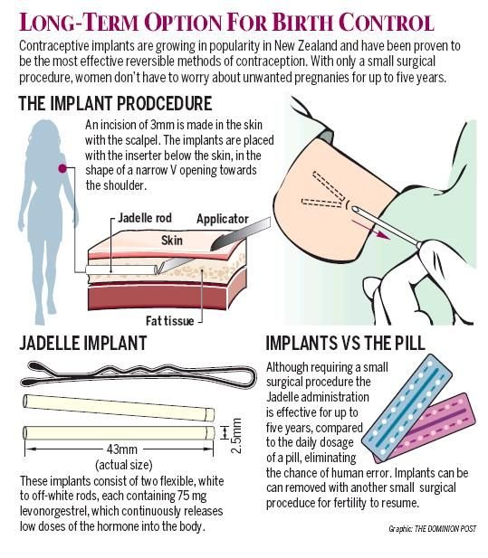 The Dangers of Certain Forms of Birth Control Women