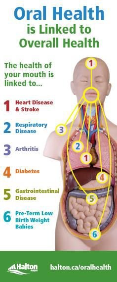 oral health is linked to overall health