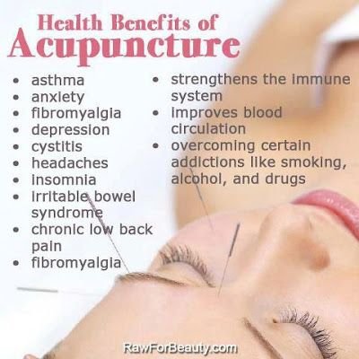 Health Benefits of Acupuncture