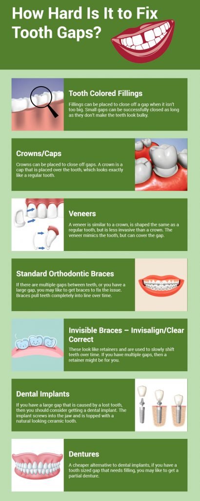 How Cosmetic Dentistry Can Help You Fix Your Gapped Teeth