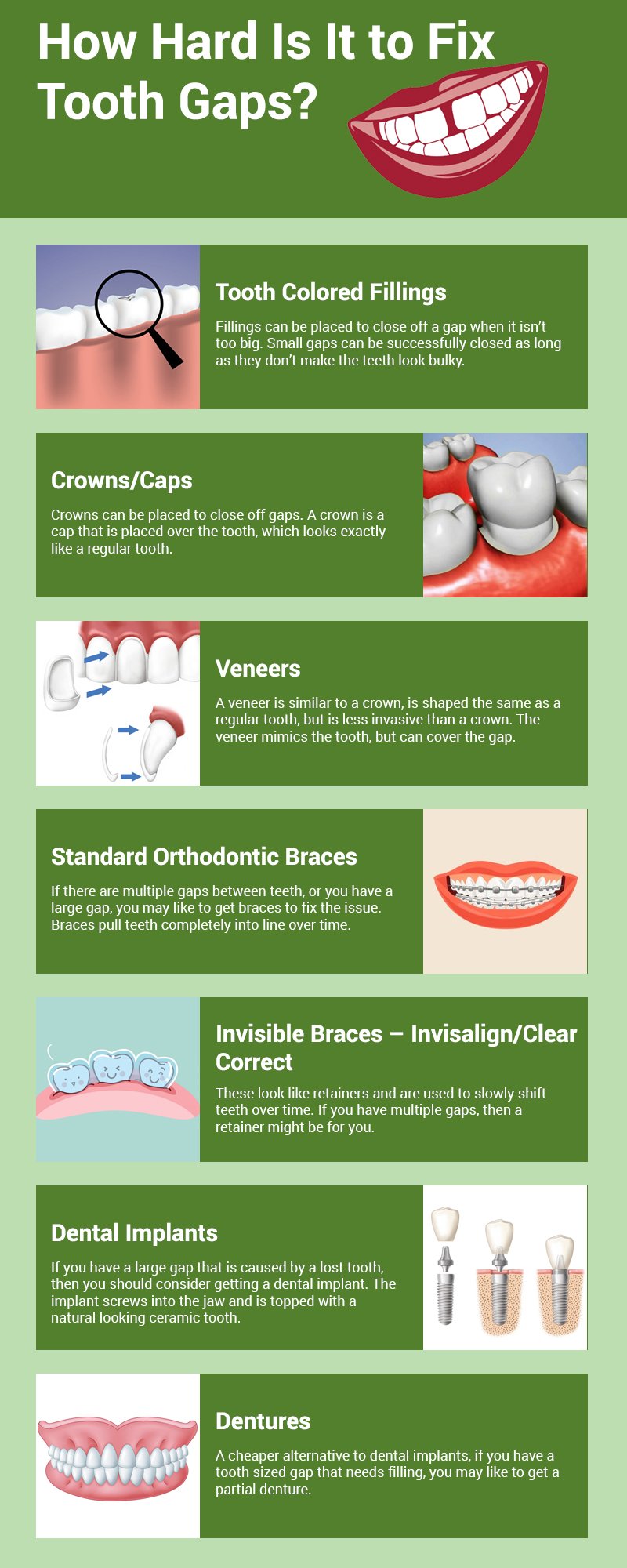 fix teeth gapped tooth gaps dentistry cosmetic help hard infographics related