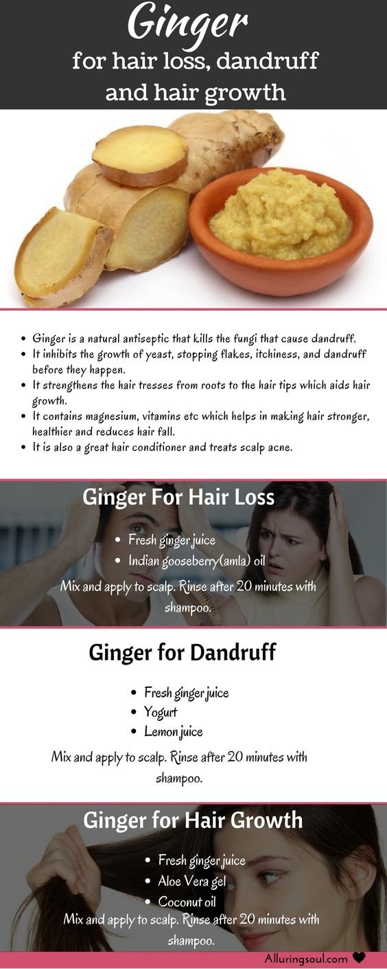 Ginger for Hair Loss Dandruff and Hair Growth