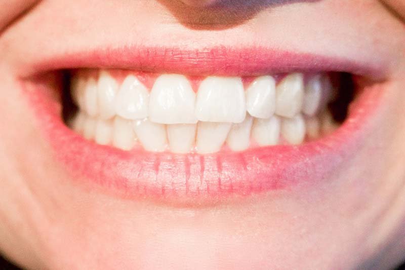 How the teeth change with time, and how you can take care of them