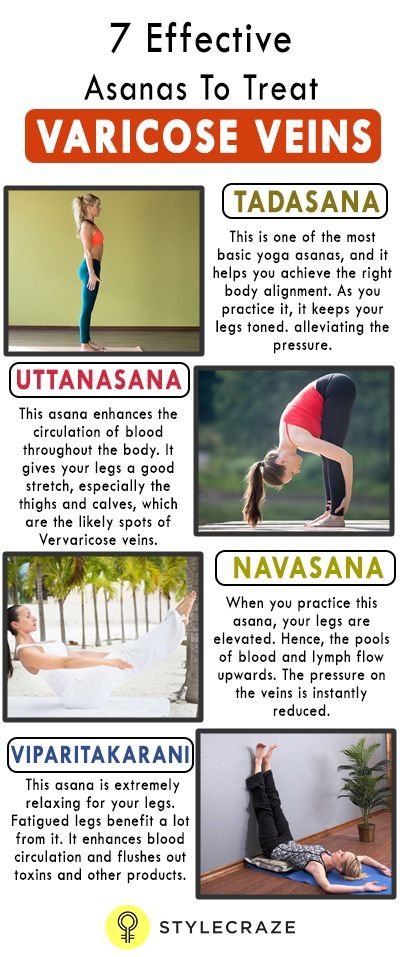 Yoga asanas to treat Varicose Veins