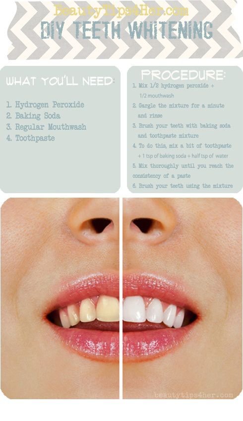 DIY Teeth Whitening