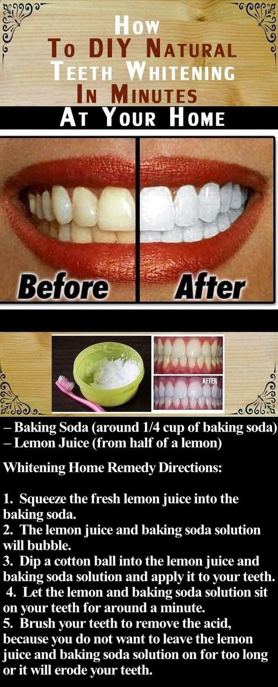 Diy Natural Teeth Whitening