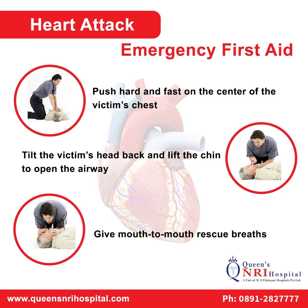 Emergency First Aid for Heart attack