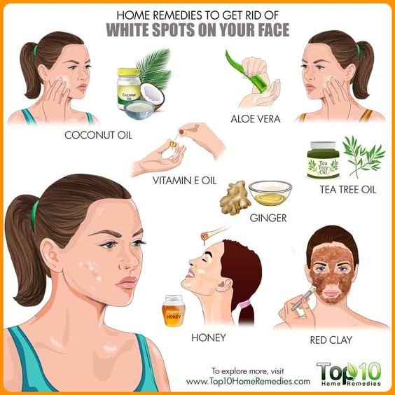 natural-ways-to-get-rid-of-white-spots-on-skin