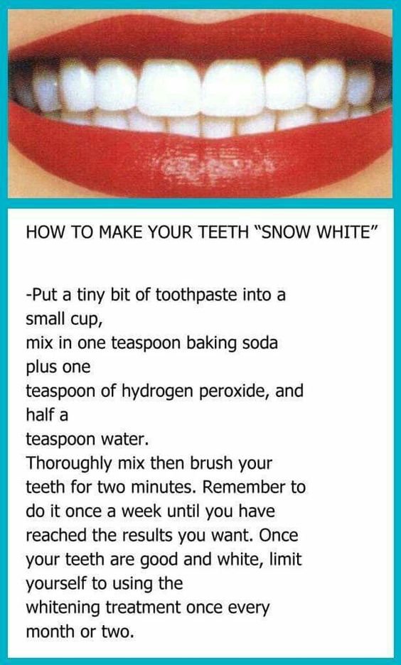 How to make your Teeth Snow White