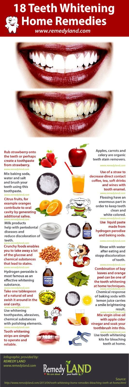 Teeth Whitening home remedies