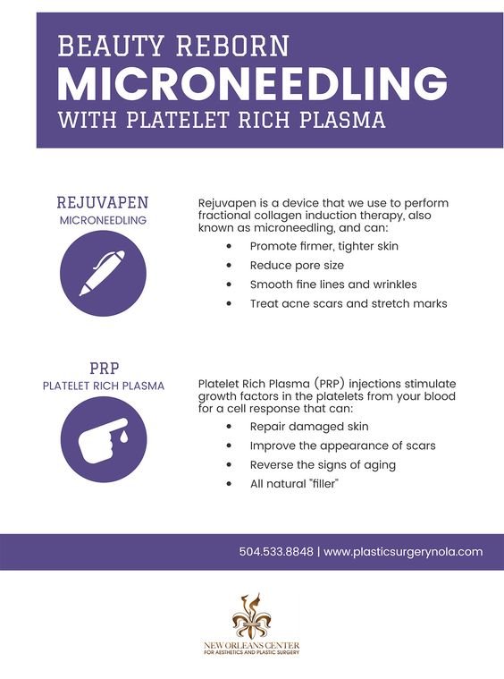 Beauty reborn MicroNeedling with platelet rich plasma