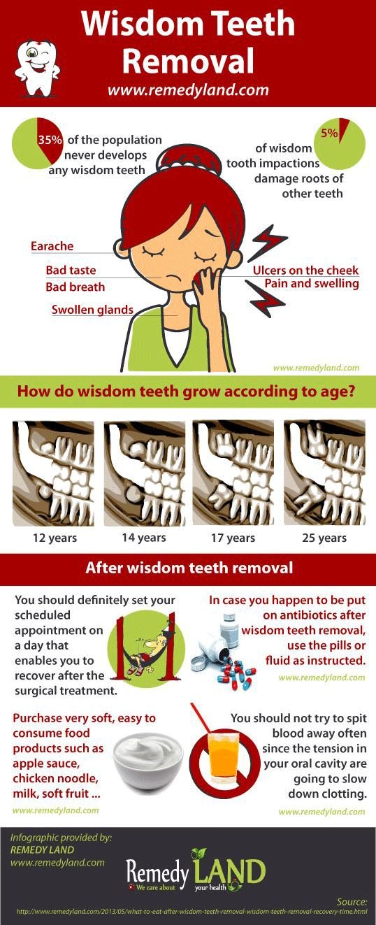 wisdom teeth removal tooth recovery eat surgery dental extraction pain oral remedies foods tips smoke soft diet warning change health