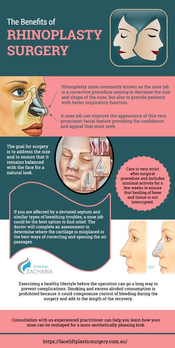 Benefits of Rhinoplasty Surgery