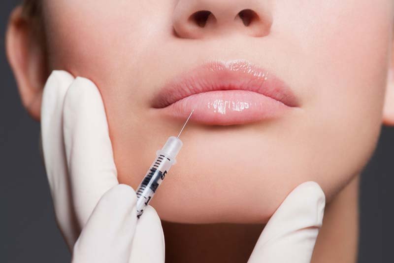 Lip Injections: Big Results with Little Commitment