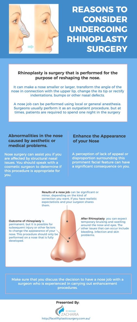 Reasons to consider undergoing Rhinoplasty Surgery