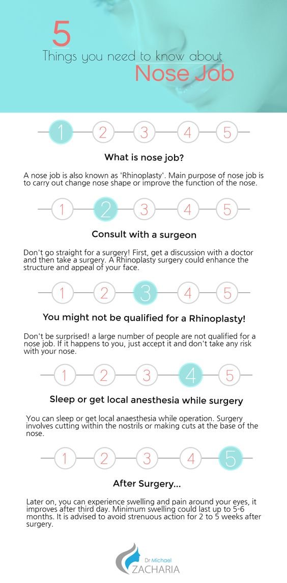 Things you need to know about Nose Job