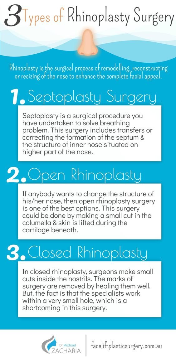 Types of Rhinoplasty Surgery