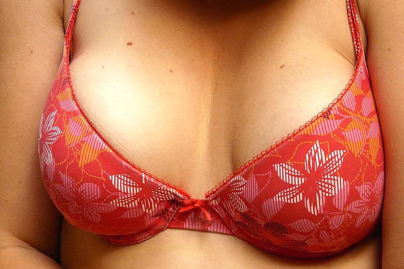 Breast Augmentation: The Questions You Should Be Asking