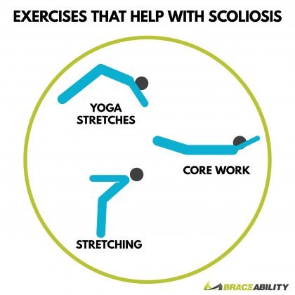 Staying Fit with Scoliosis