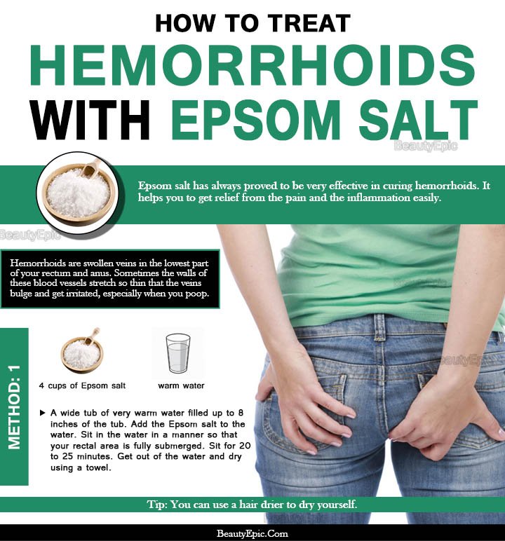 How to treat hemorrhoids with Epsom Salt